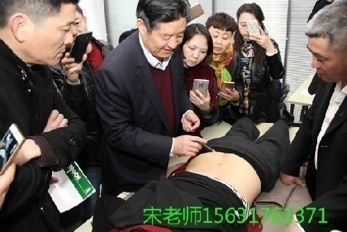 套管針培訓班(侯國文套管針、腕踝針療法培訓班)實操課